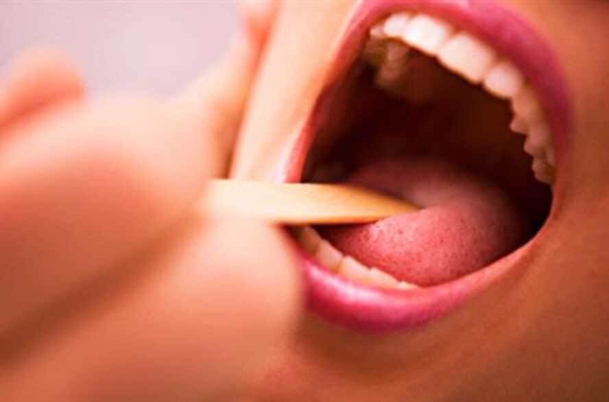 віды паразітаў у роце чалавека